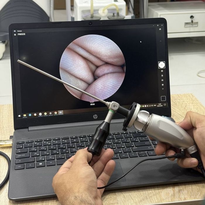 Видеоэндоскоп видеосистема Videosistema Videoendoskop videoendoscope