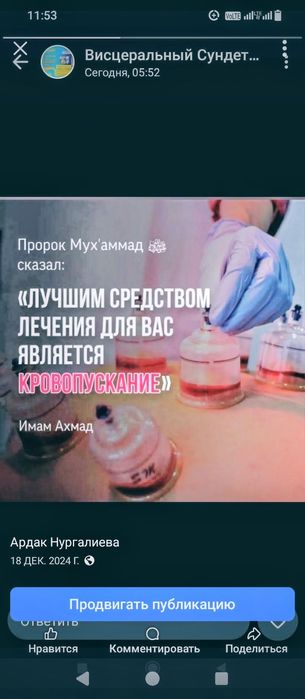 Хиджама ,массаж профессионально.Опыт 10 лет