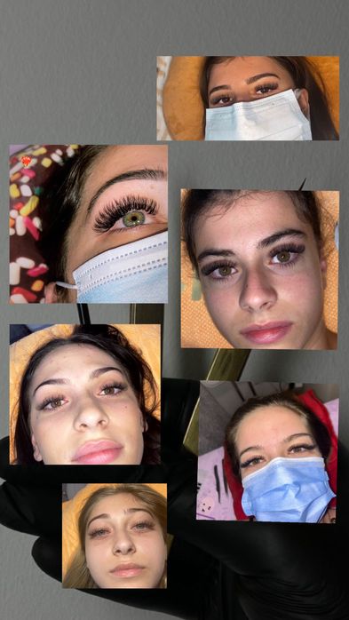 Aplic extensii gene sector 4