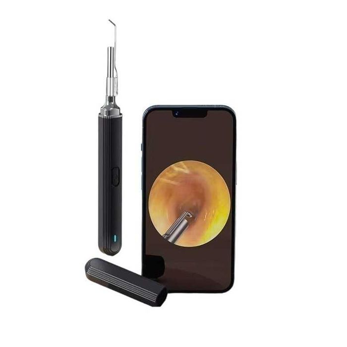 Kit Profesional Curatare Ceara Urechi Siegdorn | Otoscop HD 1080P cu LED