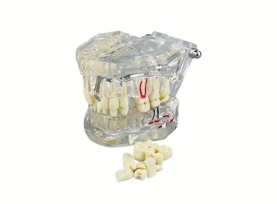 Модель зубов для стоматологов