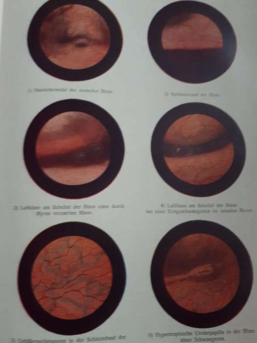 Carte de ginecologie