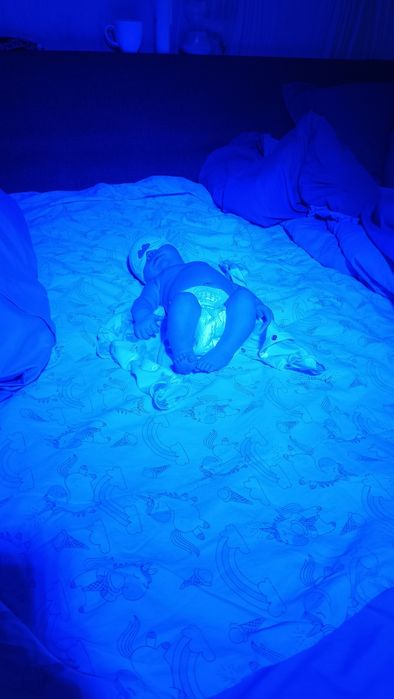 Лампа ультрафиолет от желтушки!