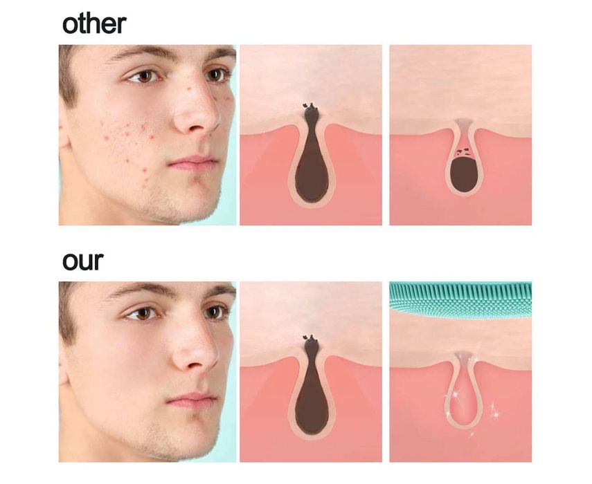 Четка за почистване на лице, водоустойчива електрическа