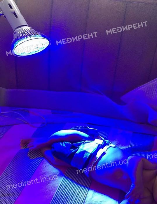 Лампа от желтухи