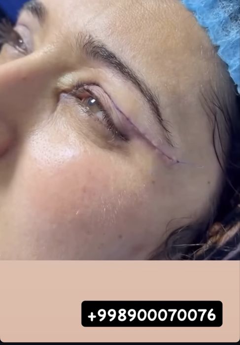 Muhabbat_cosmetolog Скидка хамма процедуралага