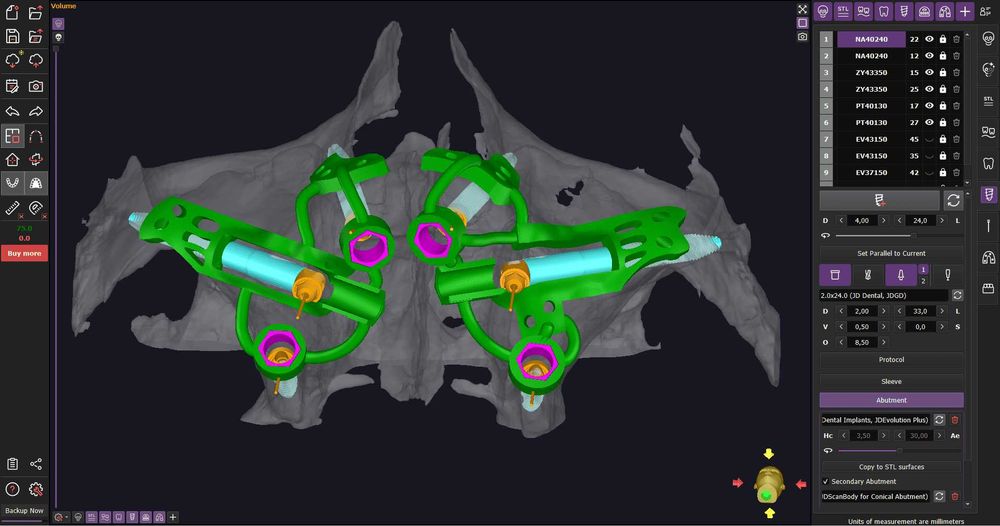 Realguide 5.4.2 + ImplantStation 5.3.2 + BlueSkyPlan + ImplantStudio