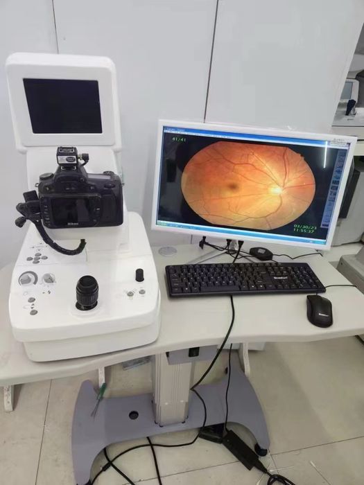 Продам Японский фундус камера