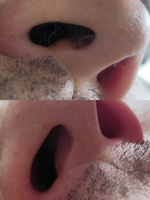 Шугаринг/Талдыкорган