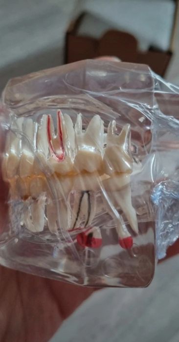 Model dentar multiple patologii