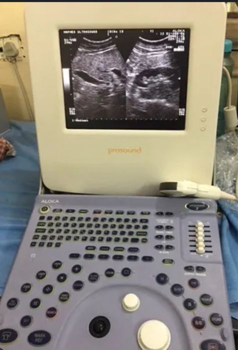 Сдам в аренду узи аппараты.