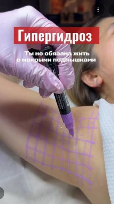 Косметолог лазерный лифтинг ,акне чистка лица мезо ,ботокс и прочии  .