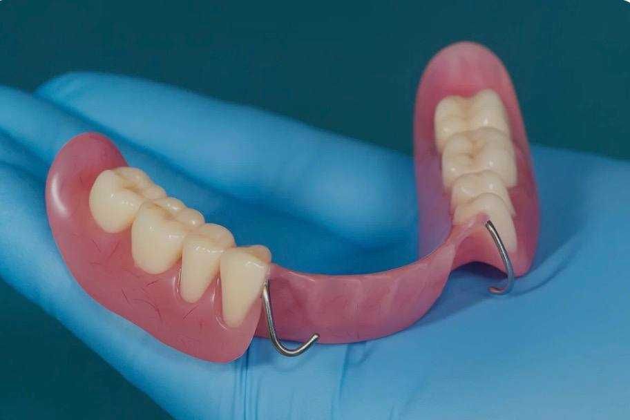 Протез на зубы Алматы