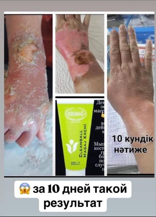 Ерсаг Турецкий компания