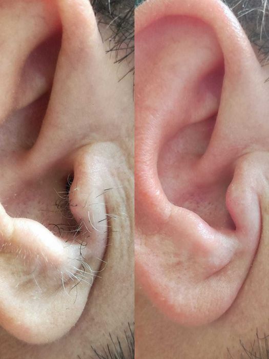 Шугаринг/Талдыкорган