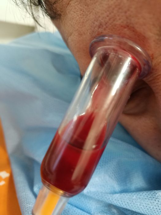 Народные методы лечения.