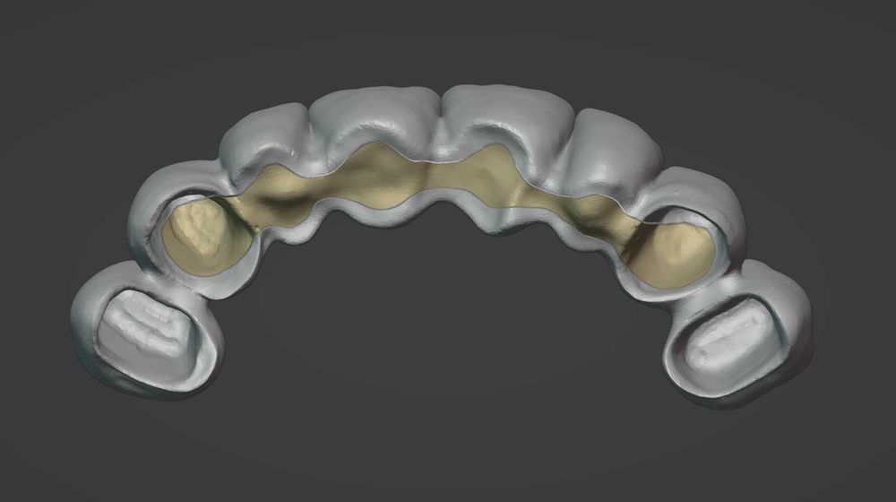 CAD/CAM дизайн |Корони, мостове, барове| 3Shape | Blender for Dental |