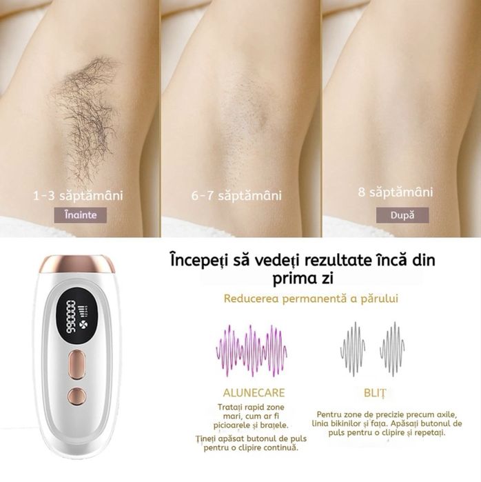 Epilator IPL EvoSmart™ R1