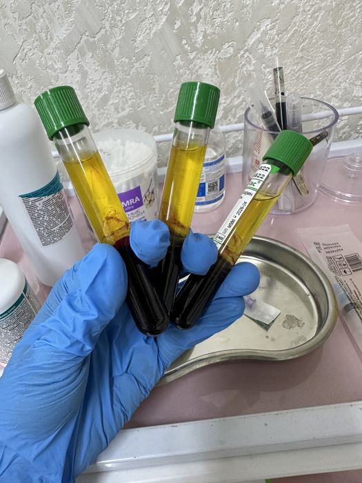 чистка плазмолифтинг косметология