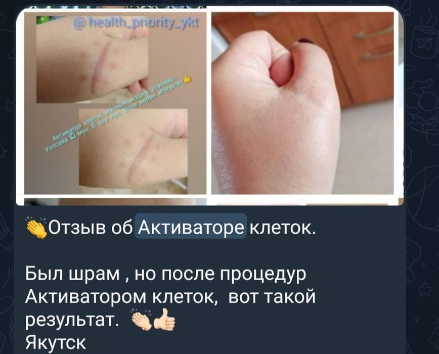 Продаётся Активатор Клеток