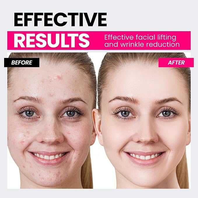 Масажор за лице  с микроток и червена светлина