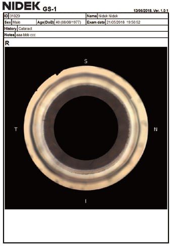 Гониоскоп NIDEK GS-1