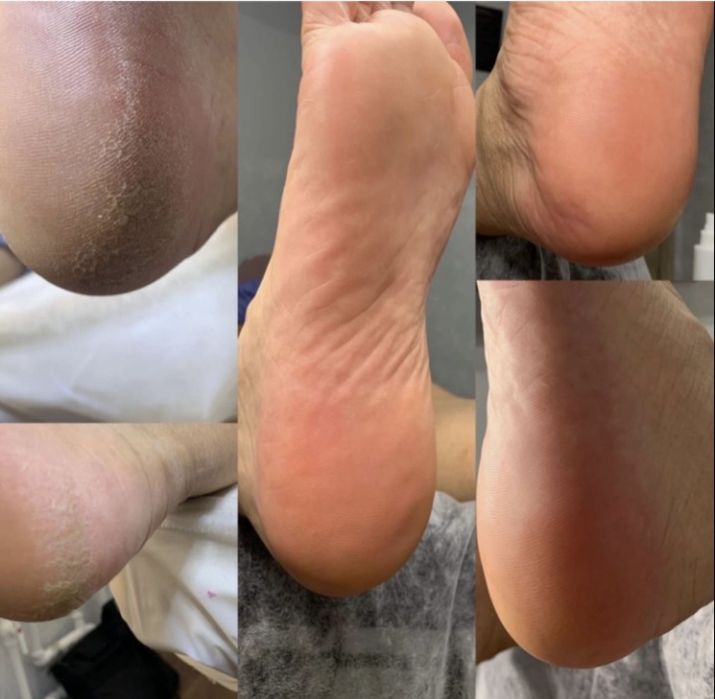 Маникюр Педикюр  на выезд