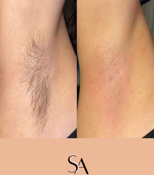 Мастер депиляции с выездом