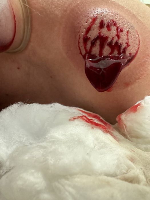 Хиджама в районе 45 квартала