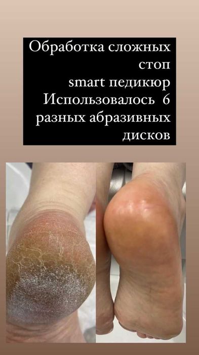 Профессиональное обучение маникюру, педикюру.