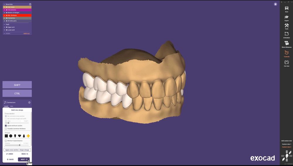 EXOCAD 3.3 Chemnitz + PartialCAD ​​3.3 + ExoPlan 3.1 + B4D iBar