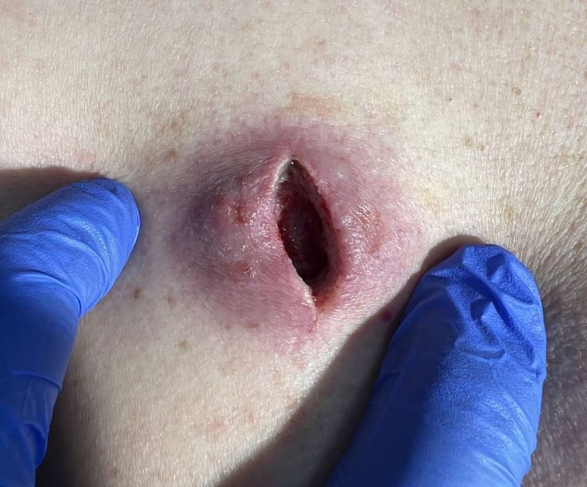 Врач-хирург на выезд