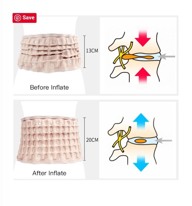 Bel og'rig'iga qarshi kamar, bel umurtqasni tortish kamari