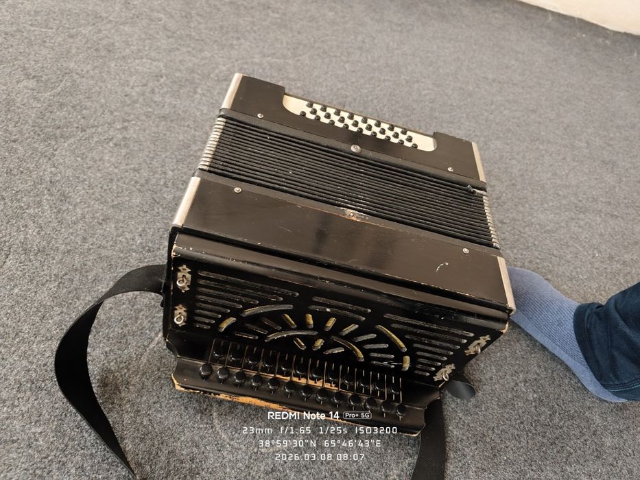 Akardion ishlashi zor umuman aybi yuq