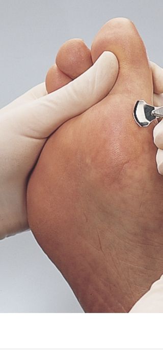 Pedichiura medicala :barbati/ dame.