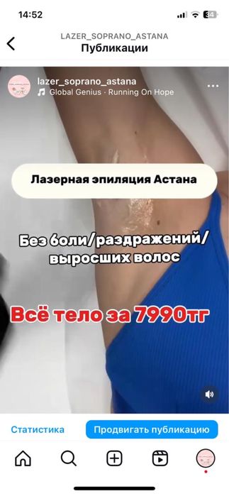 Лезерная эпиляцыя по доступным ценам, на аппарате Soprano Titanium.