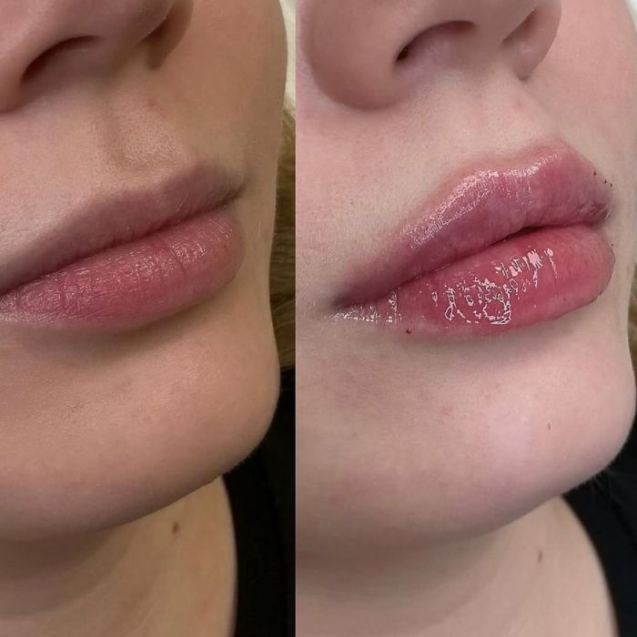 Услуги косметолога эстетиста! Все виды процедур