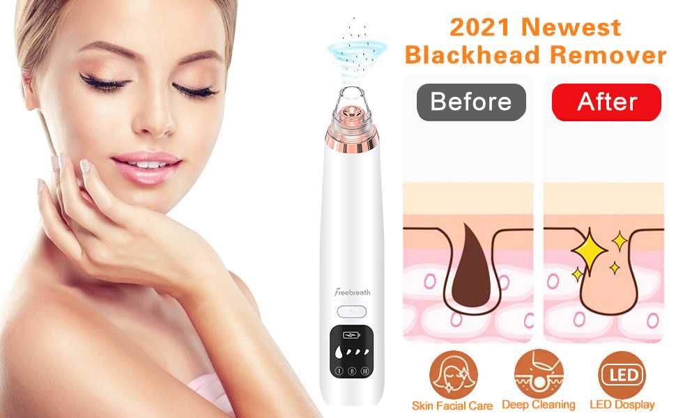 Freebreath Вакуум за отстраняване на черни точки и акне