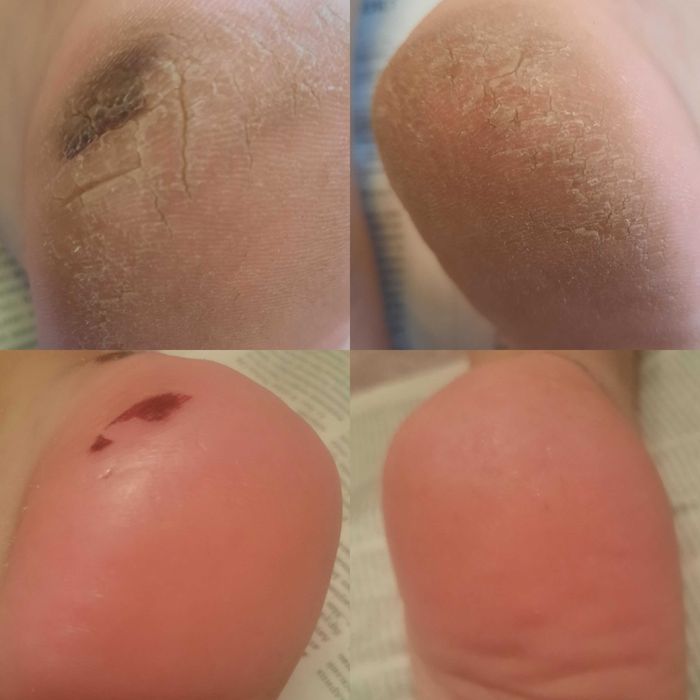 таза өкше.үйге барып