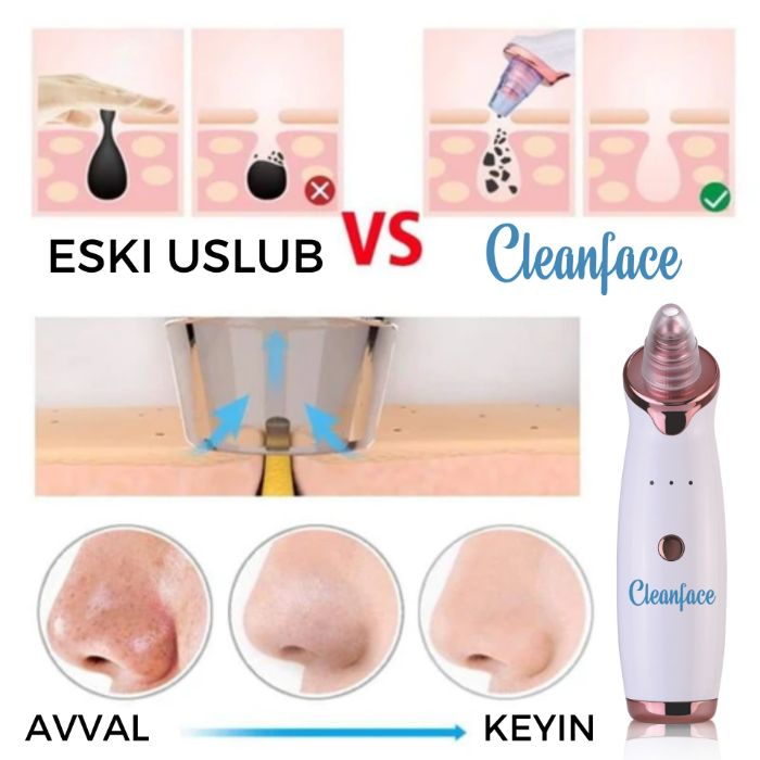 Вакуумный аппарат очиститель для лица