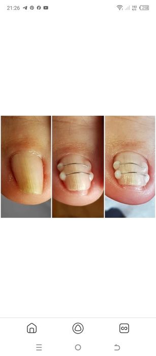 ПОДОЛОГ 22 года стаж