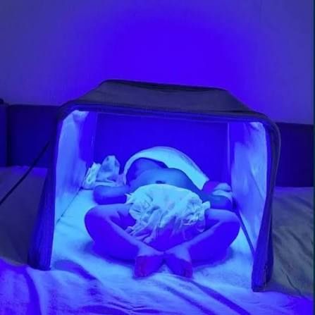 Foto lampa foto terapiya фото лампа фототерапия