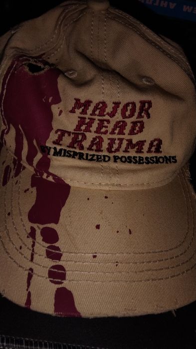 Archive cap Major head trauma
