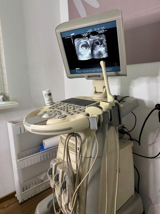 УЗИ аппарат Medison SonoAce X6
