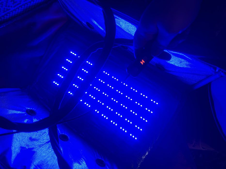 Продам лампу от желтушки