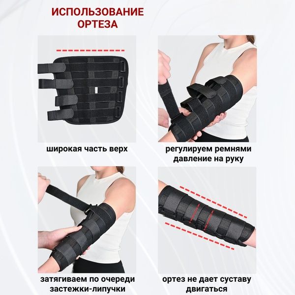 Ортез на локтевой сустав разъемный бандаж локтя с металлическими шин