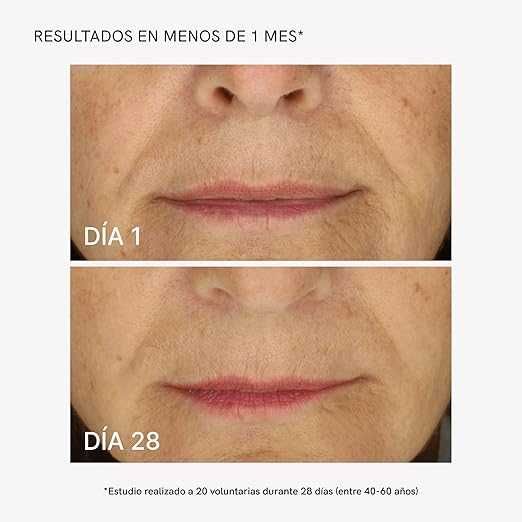 MASDERM Комплект радиочестотен апарат за лице + крем за лице 500мл