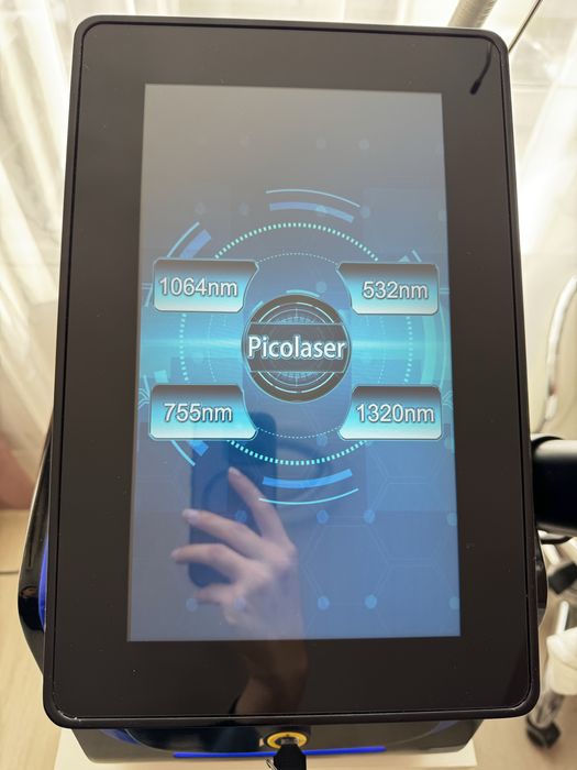 Nd Yag лазер за карбонов пилинг и премахване на перманент/татуировки