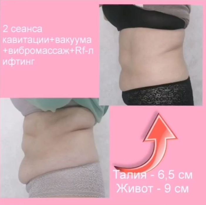 Estetik ozish tez va samarali