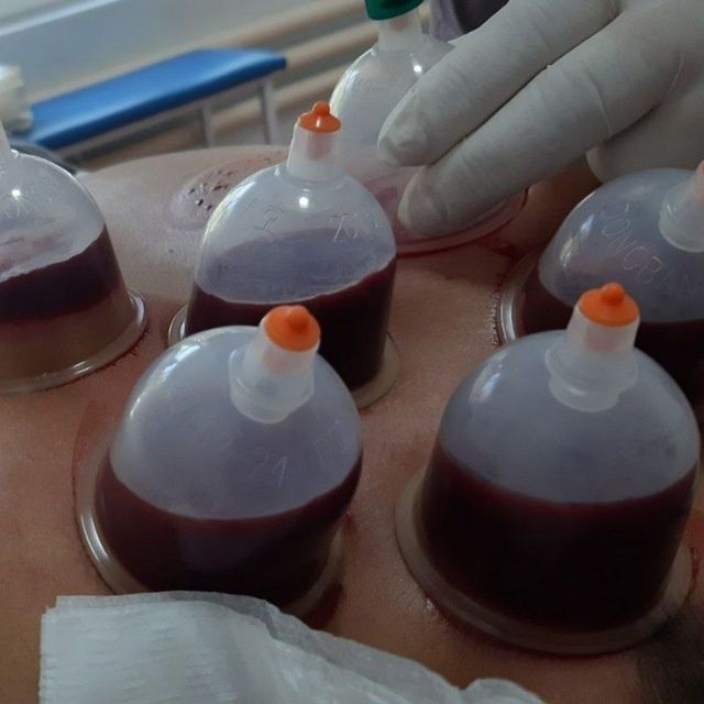 ТТз 1 возле школы 211 Навруз базар возле входа Наша Клиника